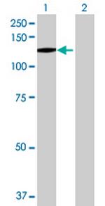 BUB1B Antibody in Western Blot (WB)