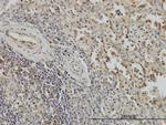 BUB1B Antibody in Immunohistochemistry (Paraffin) (IHC (P))