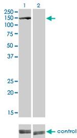 BUB1B Antibody in Western Blot (WB)