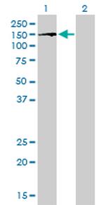 BUB1B Antibody in Western Blot (WB)