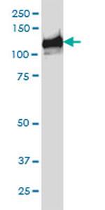 BUB1B Antibody in Western Blot (WB)