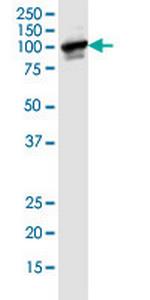 BUB1B Antibody in Western Blot (WB)