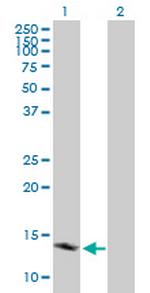 TSPO Antibody in Western Blot (WB)