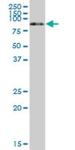 SERPING1 Antibody in Western Blot (WB)