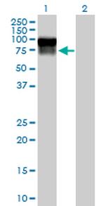 SERPING1 Antibody in Western Blot (WB)