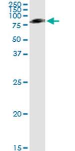 SERPING1 Antibody in Immunoprecipitation (IP)