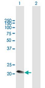 C1QC Antibody in Western Blot (WB)