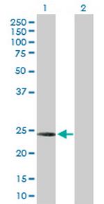 C1QC Antibody in Western Blot (WB)