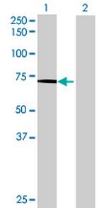 CAPN5 Antibody in Western Blot (WB)