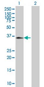 C5R1 Antibody in Western Blot (WB)