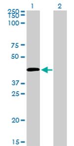 C5R1 Antibody in Western Blot (WB)