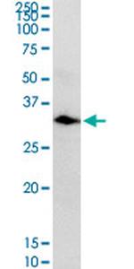 CA1 Antibody in Western Blot (WB)