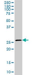 CA1 Antibody in Western Blot (WB)