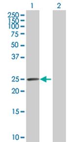 CA1 Antibody in Western Blot (WB)