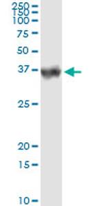 CA1 Antibody in Immunoprecipitation (IP)