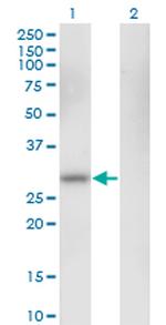 CA1 Antibody in Western Blot (WB)