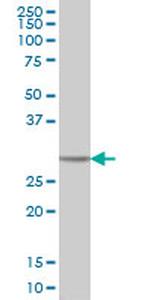 CA1 Antibody in Western Blot (WB)