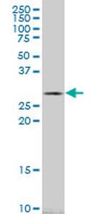 CA1 Antibody in Western Blot (WB)