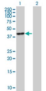 CA6 Antibody in Western Blot (WB)