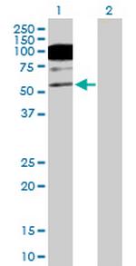 CACNB1 Antibody in Western Blot (WB)