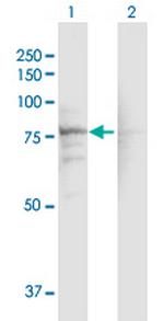 CACNB1 Antibody in Western Blot (WB)