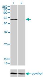 CACNB1 Antibody in Western Blot (WB)