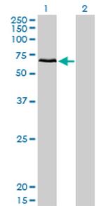 CACNB1 Antibody in Western Blot (WB)