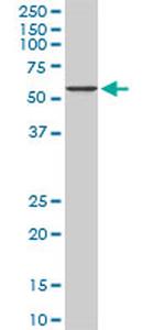 CACNB2 Antibody in Western Blot (WB)