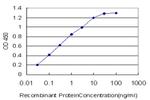 CACNB2 Antibody in ELISA (ELISA)