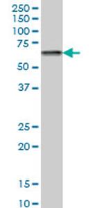 CACNB2 Antibody in Western Blot (WB)