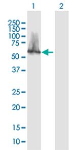 CACNB3 Antibody in Western Blot (WB)