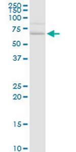 CACNB3 Antibody in Western Blot (WB)