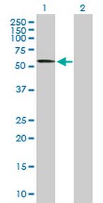 CACNB4 Antibody in Western Blot (WB)