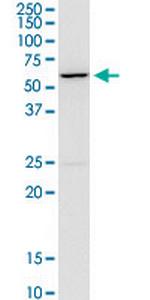 CACNB4 Antibody in Western Blot (WB)