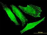 SLC25A20 Antibody in Immunocytochemistry (ICC/IF)