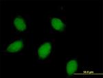 CALB1 Antibody in Immunocytochemistry (ICC/IF)