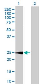 CALB1 Antibody in Western Blot (WB)