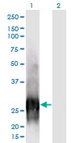 CALB1 Antibody in Western Blot (WB)