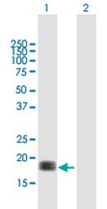 CALM3 Antibody in Western Blot (WB)