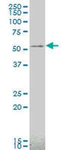 CAMK2A Antibody in Western Blot (WB)