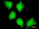 CAMK2A Antibody in Immunocytochemistry (ICC/IF)