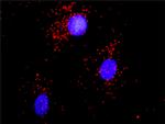 CAMK2A Antibody in Proximity Ligation Assay (PLA) (PLA)