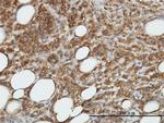 CAMK2B Antibody in Immunohistochemistry (Paraffin) (IHC (P))