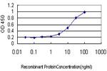 CAMK2B Antibody in ELISA (ELISA)