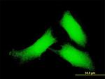 CAMK2D Antibody in Immunocytochemistry (ICC/IF)