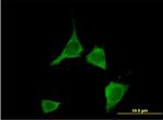 CAMK2D Antibody in Immunocytochemistry (ICC/IF)