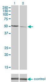 CAMK2D Antibody in Western Blot (WB)