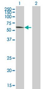 CAMK2G Antibody in Western Blot (WB)