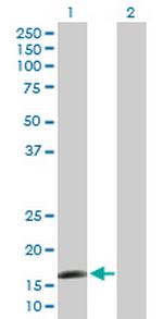 CAMP Antibody in Western Blot (WB)