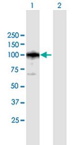 CAST Antibody in Western Blot (WB)